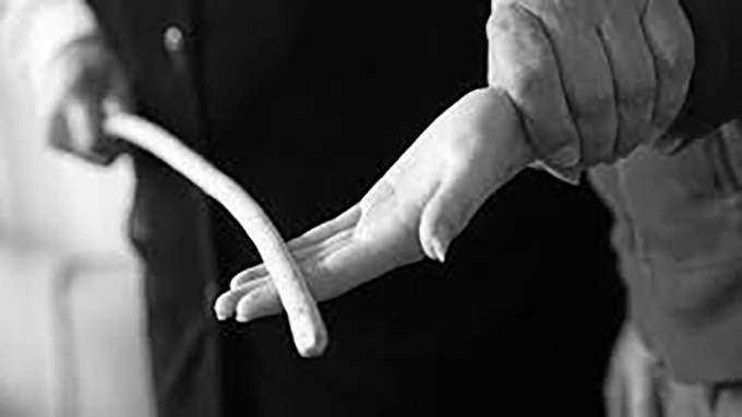 School spankings are banned just about everywhere around the world except in US